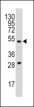 WB - Urokinase (PLAU) Antibody (N-term) AP8161a